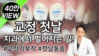 치아교정 첫날에는 어떤 일들이 벌어질까? 교정장치 부착과정부터 통증까지 총정리!