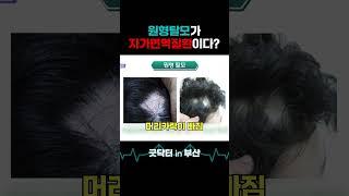 원형탈모가 자가면역질환? 함께 알아봅시다! #shorts #굿닥터인부산 #탈모 #탈모치료 #탈모원인 #원형탈모 #원형탈모원인 #자가면역질환