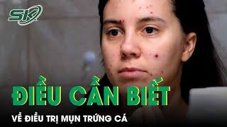 Điều Cần Biết Về Điều Trị Mụn Trứng Cá l SKĐS