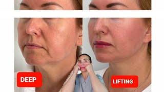 DEEP LIFTING massage | Sagging Jowls | Nasolabial Folds | Double chin