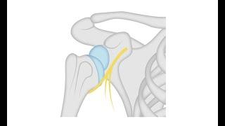 Diagnosing a shoulder dislocation