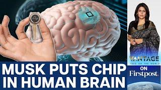 Elon Musk's Neuralink puts First Brain Chip in a Human | Vantage with Palki Sharma