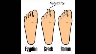 Do You Have This LONGER TOE? Then BEWARE with the GREEK FOOT!!