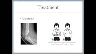 Supracondylar fractures - Session 7 - 11h20 - Stewart Dix Peek