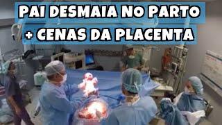 PAI DESMAIA DURANTE O NASCIMENTO - Vídeo de Parto Cesárea com cenas da placenta