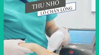 Triệt Lông Vĩnh Viễn Tại Hải Phòng Ưu Đãi 30% - Permanent hair removal With Venus Legacy