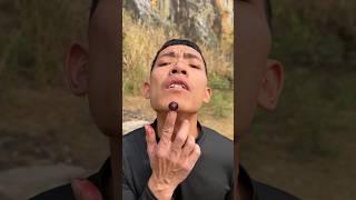 How I Cured a Bug Bite with Yogurt in the Wild | Survival Hacks #short