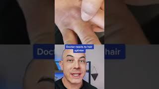 Derm reacts to crazy hair splinter! #barber #hairsplinter #dermreacts #splinterremoval