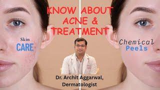 Skincare Secrets: Why Experts Choose Chemical Peels for Acne #wrinkles