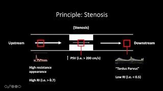 Doppler Ultrasound Part 1 - Principles (w/ focus on Spectral Waveforms)