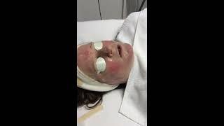 Urban Body Laser Skin Rejuvenation And Laser Hair Removal Call 604-696-5506