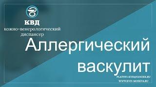 483  Аллергический васкулит