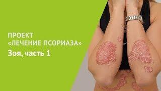 Проект Лечение псориаза. Зоя, часть 1