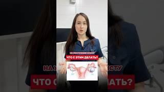 #киста #кистаяичника #гинеколог #женскоездоровье #врачи