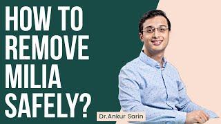 All about milia and how to remove Milia safely at home | Dr. Ankur Sarin