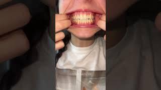 GIULIASMOUTH #asmr #mouth #tongue #eating