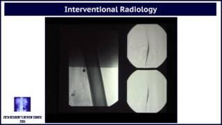 13 Interventional Radiology TRAILER