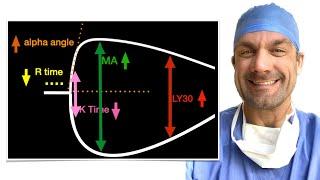 Understand TEG - Thromboelastogram!  Make it easy!