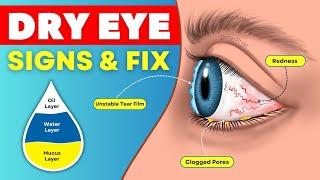 6 Dry Eye Signs You’re Ignoring  & Natural Ways to Fix it