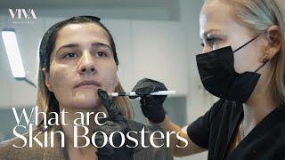 Skin Booster: What is a Skin Booster? Skin Boosters Treatment with Before and Afters