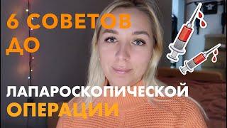 6 ВАЖНЫХ СОВЕТОВ ДО Лапароскопической операции.