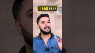 Puffy Eyes, Eye Bags & Dark Circles Treatment: Solution for Brighter Eyes