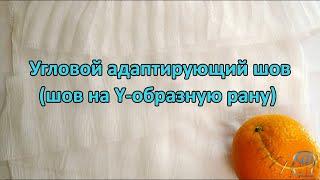 Техника наложения углового адаптирующего шва. Как наложить шов на рваную рану