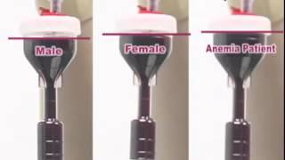 PRP Y CELLBIO MEDICAL