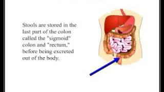 Irritable Bowel Syndrome