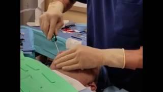 Dr. Jabor - Lower Facelift - Cosmetic Surgery & Laser Centers of El Paso