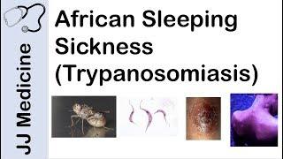 African Sleeping Sickness (Trypanosomiasis) | Causes, Symptoms and Treatment