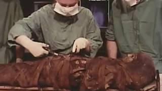 Mummy 1770: Unwrapping mummy from Roman era