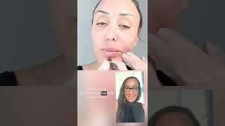 See you later lines, wrinkles , sunspots , melasma ️ #microneedling #skincare #skin #beauty
