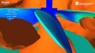 CFD Simulations of Solid Liquid Mixing in a Stirred Tank for Troubleshooting and Optimization