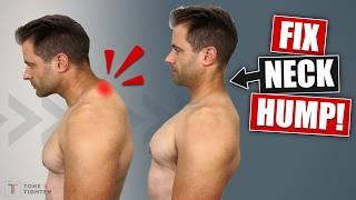 How To Fix Neck Hump At Home [Best Stretches and Exercises!]