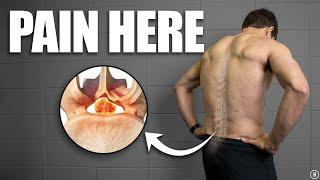 Lumbar Spinal Stenosis Rehab (Education | Exercises | Surgery | Myths)