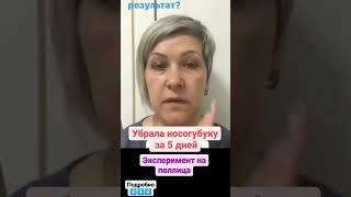 Убрать морщины без уколов. Бионетика. Сибирское здоровье