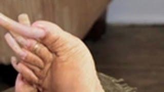 Growing Massive Toenails | My Strange Addiction