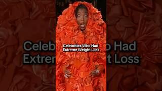 Celebrities Who Had Extreme Weight Loss 