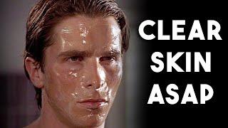 How To Get Clear Skin ASAP (NO BS GUIDE)