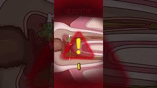 Root Canal Pain EXPLAINED!  | What REALLY Happens Inside Your Tooth 