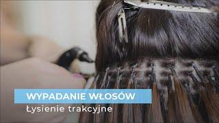 Łysienie trakcyjne - łysienie z pociągania