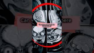 Rare & Strange Photos That Will Blow Your Mind. (pt. 6)