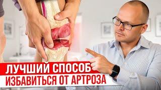 Как Лечить Артроз Коленного Сустава? Это Лучший Способ Избавиться От Проблемы!