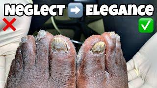 Pedicure Transformation: From Neglect to Elegance