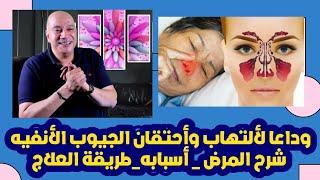 علاج الجيوب الأنفيه المتعبه/اسرار البابونج / الزعتر / زيت الحبه السوداء