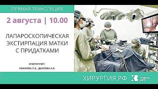 Лапароскопическая экстирпация матки с придатками