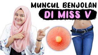 MACAM-MACAM BENJOLAN DI MISS V - DOKTER WSP