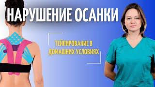 НАРУШЕНИЯ ОСАНКИ: тейпирование в домашних условиях