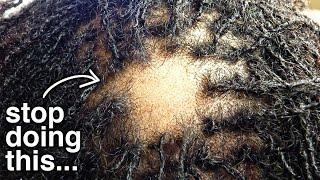 Stop Doing THIS To Your Dreadlocks!